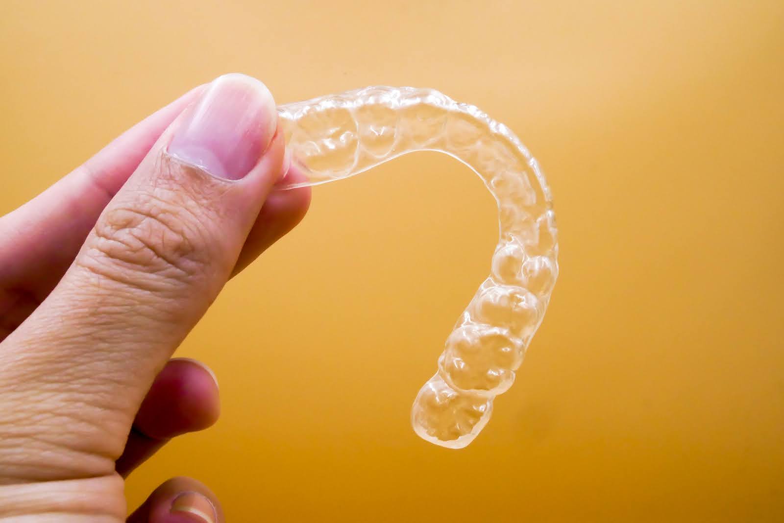 Invisalign timeline: how long does it take
